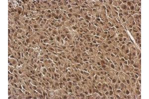 Immunohistochemistry (IHC) image for anti-Fibroblast Growth Factor 13 (FGF13) antibody (ABIN2854901)