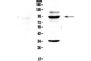 Western blot analysis of BRD7 using anti-BRD7 antibody . (BRD7 Antikörper  (AA 514-567))