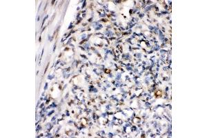 IHC analysis of ZEB1 using anti-ZEB1 antibody (ABIN7602984). (ZEB1 Antikörper  (Middle Region))