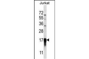 Western blot analysis in Jurkat cell line lysates (35ug/lane). (PFDN5 Antikörper  (AA 79-108))