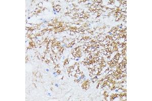 Immunohistochemistry of paraffin-embedded mouse spinal cord using CTNN antibody (ABIN7266134) at dilution of 1:100 (40x lens). (CTNNA2 Antikörper  (AA 150-300))