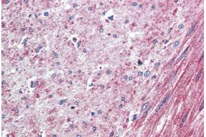 Human Colon, Smooth Muscle (formalin-fixed, paraffin-embedded) stained with ELTD1 antibody ABIN410769 followed by biotinylated goat anti-rabbit IgG secondary antibody ABIN481713, alkaline phosphatase-streptavidin and chromogen. (ELTD1 Antikörper  (N-Term))