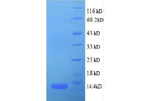 SDS-PAGE (SDS) image for Chemokine (C-X-C Motif) Ligand 5 (CXCL5) (AA 37-110), (partial) protein (His tag) (ABIN1046747)