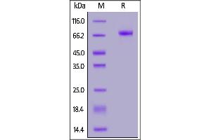 Biotinylated Human LRRC15, His,Avitag on  under reducing (R) condition. (LRRC15 Protein (AA 22-538) (His tag,AVI tag,Biotin))
