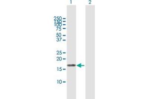 Western Blot analysis of EIF5A2 expression in transfected 293T cell line by EIF5A2 MaxPab polyclonal antibody. (EIF5A2 Antikörper  (AA 1-153))