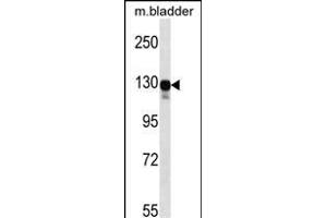 Mouse Map3k6 Antibody (N-term) (ABIN657839 and ABIN2846801) western blot analysis in mouse bladder tissue lysates (35 μg/lane).