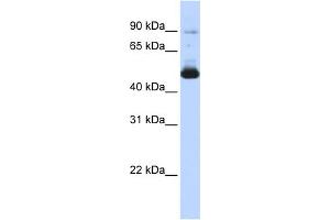 WB Suggested Anti-KRT16 Antibody Titration: 0. (KRT16 Antikörper  (Middle Region))