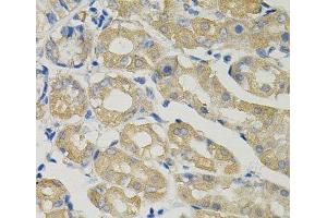 Immunohistochemistry of paraffin-embedded Human stomach using SLC30A1 Polyclonal Antibody (SLC30A1 Antikörper)