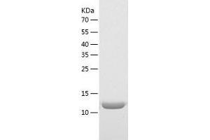 Western Blotting (WB) image for Interleukin 26 (IL26) (AA 22-171) protein (His tag) (ABIN7288967) (IL-26 Protein (AA 22-171) (His tag))