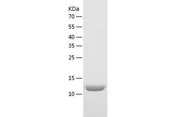 IL-26 Protein (AA 22-171) (His tag)