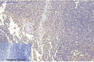Immunohistochemical analysis of paraffin-embedded human tonsil tissue. (MAP2 Antikörper)