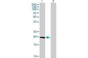Western Blot analysis of IL23A expression in transfected 293T cell line by IL23A MaxPab polyclonal antibody. (IL23A Antikörper  (AA 1-189))