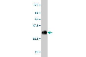 Western Blot detection against Immunogen (36. (COQ8A Antikörper  (AA 1-100))