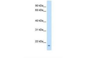 Image no. 1 for anti-Family with Sequence Similarity 107, Member A (FAM107A) (C-Term) antibody (ABIN320713) (FAM107A Antikörper  (C-Term))