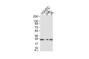 Western blot analysis of extracts from HUVEC cells (Lane 1), colo cells (Lane 2) and JK cells (Lane 3), using Caveolin-1 Antibody. (Caveolin-1 Antikörper)
