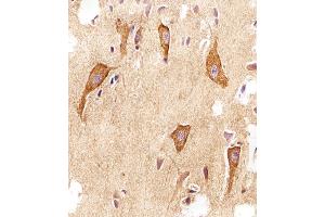 Immunohistochemical analysis of paraffin-embedded H. (VAMP8 Antikörper  (N-Term))