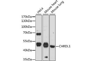 Western blot analysis of extracts of various cell lines, using CHRDL1 antibody (ABIN7266351) at 1:1000 dilution. (CHRDL1 Antikörper  (AA 289-458))