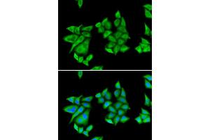 Immunofluorescence (IF) image for anti-Uroporphyrinogen Decarboxylase (UROD) antibody (ABIN1876681) (UROD Antikörper)