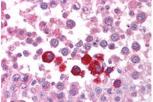 Human Testis (formalin-fixed, paraffin-embedded) stained with CHEK2 antibody ABIN213921 at 5 ug/ml followed by biotinylated goat anti-rabbit IgG secondary antibody ABIN481713, alkaline phosphatase-streptavidin and chromogen.