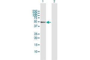 Western Blot analysis of PSMD5 expression in transfected 293T cell line by PSMD5 MaxPab polyclonal antibody. (PSMD5 Antikörper  (AA 1-504))