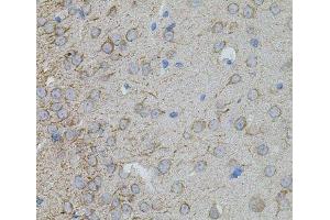 Immunohistochemistry of paraffin-embedded Mouse brain using MMP10 Polyclonal Antibody at dilution of 1:100 (40x lens).