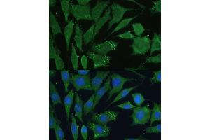 Immunofluorescence (IF) image for anti-Calcitonin-Related Polypeptide alpha (CALCA) (AA 1-141) antibody (ABIN6137852)