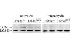 Immunoblots for LC3 protein (LC3B Antibody ) are shown for extracts from untreated or rapamycin-treated (250 nM, 4 h) cultures of wild-type (CbCln3+/+) or homozygous cerebellar cells (CbCln3Äex7/8/Äex7/8). (LC3B Antikörper  (N-Term))