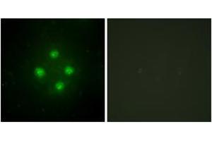 Immunofluorescence analysis of HuvEc cells, using MED24 Antibody.