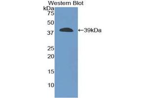 Western blot analysis of the recombinant protein. (CPB1 Antikörper  (AA 109-415))