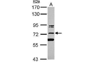 WB Image Sample (30 ug of whole cell lysate) A: Jurkat 7. (KIAA0020 Antikörper  (Center))