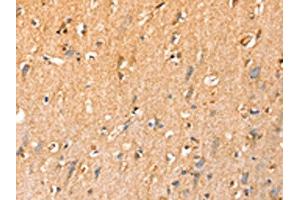 The image on the left is immunohistochemistry of paraffin-embedded Human brain tissue using ABIN7192442(SLC25A3 Antibody) at dilution 1/35, on the right is treated with synthetic peptide. (SLC25A3 Antikörper)
