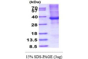 HOXB13 Protein (AA 1-284) (His tag)