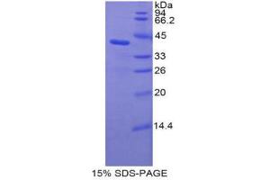 SDS-PAGE (SDS) image for Complement Fragment 3a (C3a) (AA 671-748) protein (His tag,GST tag) (ABIN1879865) (C3a Protein (AA 671-748) (His tag,GST tag))