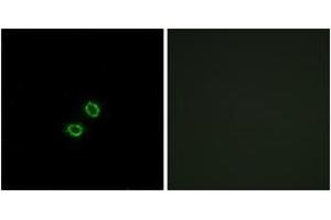 Immunofluorescence analysis of A549 cells, using KIR2DL5B Antibody. (KIR2DL5B Antikörper  (AA 161-210))