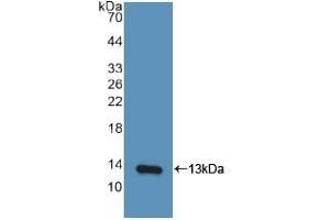 CXCL10 抗体  (AA 22-98)