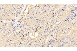 Detection of CD40L in Human Kidney Tissue using Monoclonal Antibody to Cluster Of Differentiation 40 Ligand (CD40L) (CD40 Ligand Antikörper  (AA 48-244))