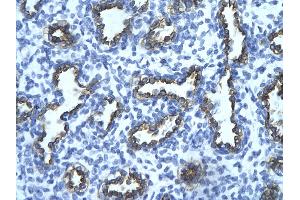 Human Lung; . (TRIM13 Antikörper  (Middle Region))