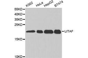 Western Blotting (WB) image for anti-Lipopolysaccharide-Induced Tumor Necrosis Factor-alpha Factor (LITAF) antibody (ABIN1876657) (LITAF Antikörper)