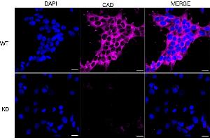 Immunocytochemical staining of HeLa cells using CAD antibody (ABIN7797866), 1:1,000), Top panel: wild-type (WT), Bottom panal: CAD shRNA knockdown (KD).