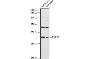 Western blot analysis of extracts of various cell lines, using INSIG2 antibody (ABIN7267888) at 1:1000 dilution. (INSIG2 Antikörper  (AA 50-150))