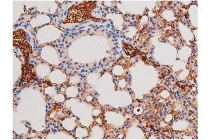 Immunohistochemistry (IHC) image for anti-Adducin 1 (Alpha) (ADD1) (pSer726) antibody (ABIN6255485)