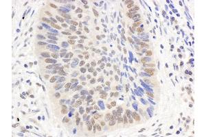 Immunohistochemistry (IHC) image for anti-E1A Binding Protein P300 (EP300) (AA 1000-1050) antibody (ABIN7454617) (p300 Antikörper  (AA 1000-1050))