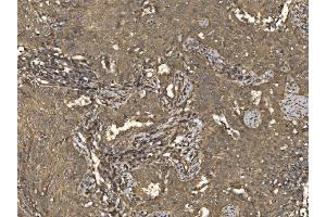 IHC analysis of EIF5 using anti-EIF5 antibody (ABIN7599722).