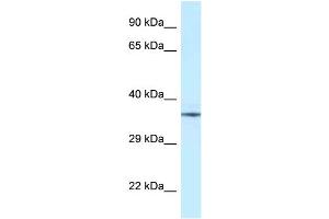 WB Suggested Anti-NUDT6 Antibody Titration: 1. (NUDT6 Antikörper  (Middle Region))