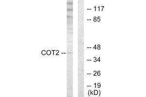 Western Blotting (WB) image for anti-Grr1p (GRR1) (N-Term) antibody (ABIN1849262) (Grr1p Antikörper  (N-Term))