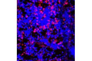Immunofluorescence of paraffin embedded mouse bone using CD177 (ABIN7073372) at dilution of 1:500 (400x lens) (CD177 Antikörper)