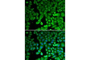 Immunofluorescence analysis of U2OS cells using NR4A1 antibody (ABIN6293398). (NR4A1 Antikörper)
