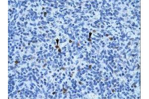 Image no. 1 for anti-Annexin A3 (ANXA3) (N-Term) antibody (ABIN202243) (Annexin A3 Antikörper  (N-Term))
