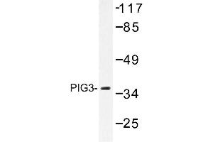 Image no. 1 for anti-Tumor Protein P53 Inducible Protein 3 (TP53I3) antibody (ABIN272242) (TP53I3 Antikörper)