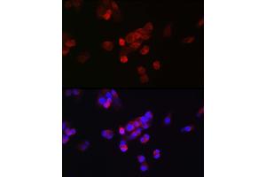 Immunofluorescence analysis of HepG2 cells using FGF23 antibody (ABIN6127894, ABIN6140600, ABIN6140602 and ABIN6221721) at dilution of 1:25. (FGF23 Antikörper  (AA 25-251))